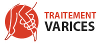 Traitement des varices au maroc avec des techniques innovantes avec ou sans chirurgie - veinous center